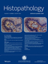 腫瘤學|細胞生物學sci期刊HISTOPATHOLOGY